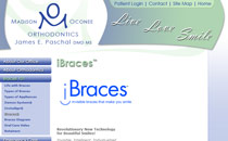 iBraces&trade;