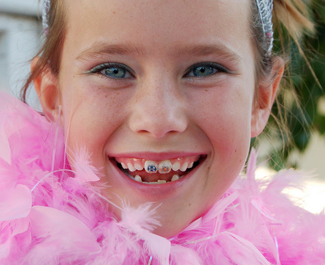 Orthodontic Treatment for All Ages